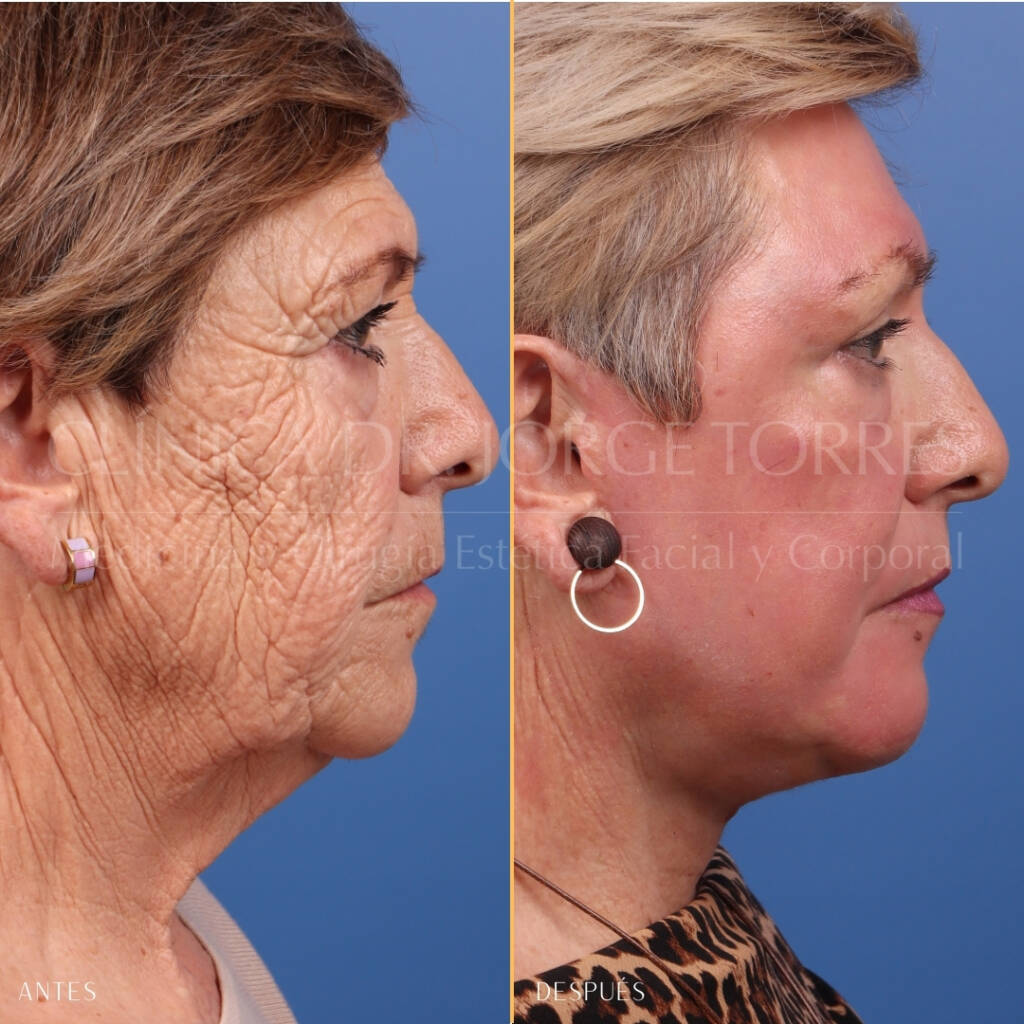16521-MRGN-24-lat-zoom-facial