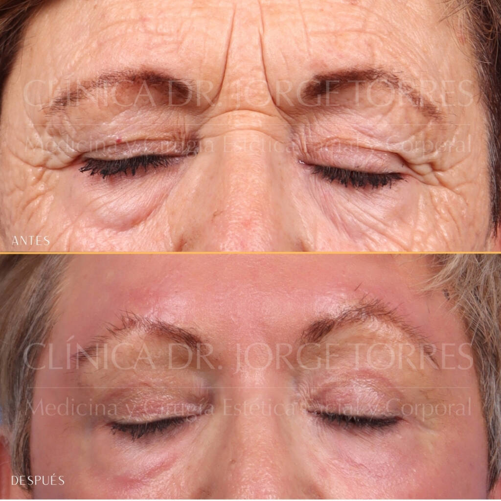 16521-MRGN-35-Ojos-cerrado