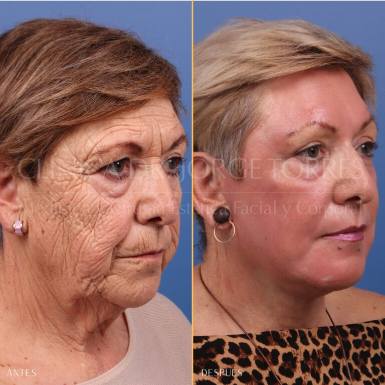 16521-MRGN-02-obli-der-768x768